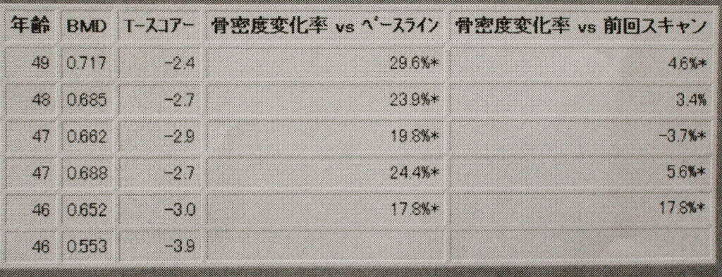 骨粗しょう症治療開始から3年、経過レポート